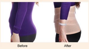 POSTPARTUM GIRDLE BEFORE AND AFTER